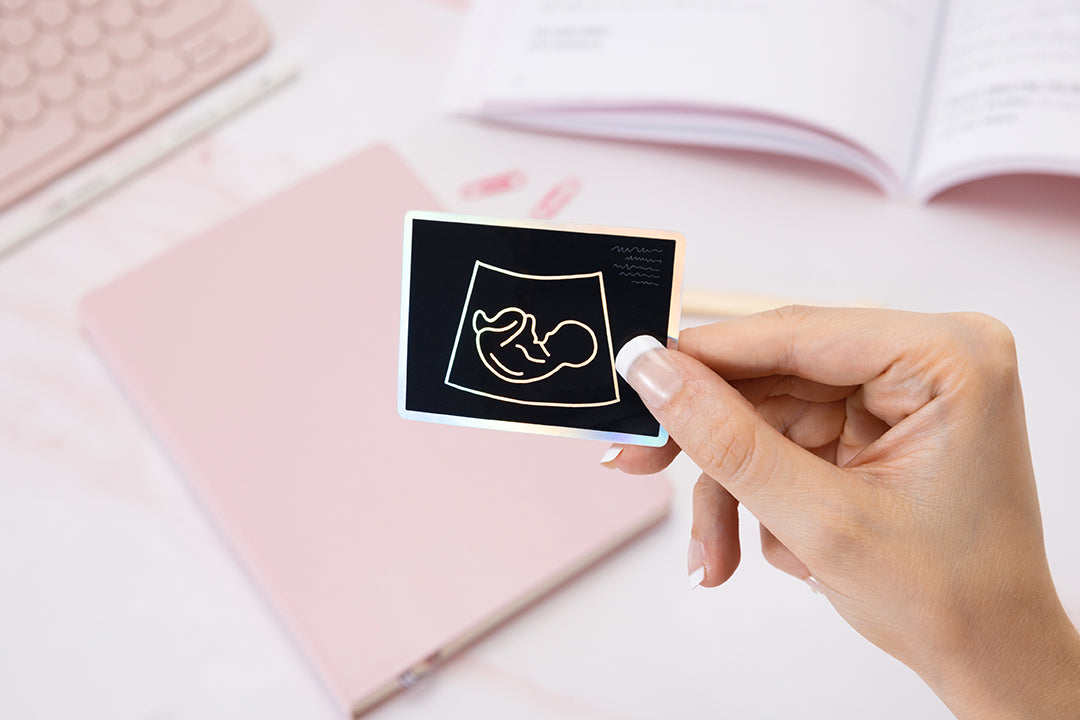 Baby Scan Ink Holographic Waterproof Vinyl Baby Scan Sticker – The Awesome Anatomy ...